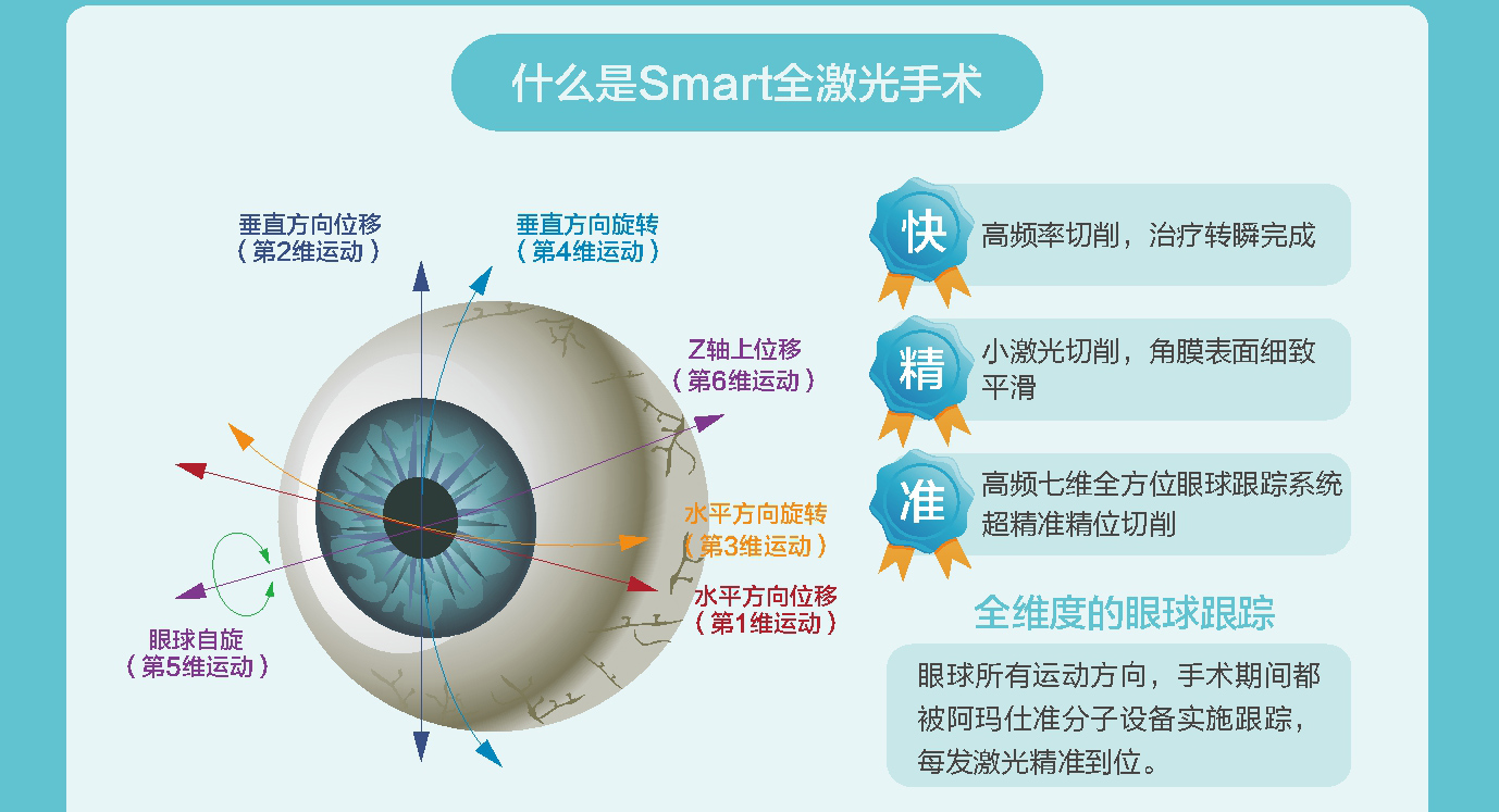 永州Smart晴逸全激光手术，安心之选·逸享无忧(图3)